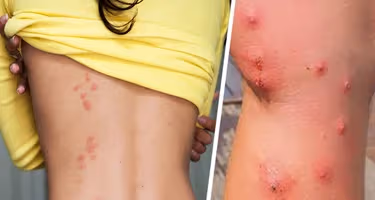 Лаосский отдых обернулся трагедией: смертельное нападение ядовитых насекомых на туристов Лаосский отдых обернулся трагедией: смертельное нападение ядовитых насекомых на туристов